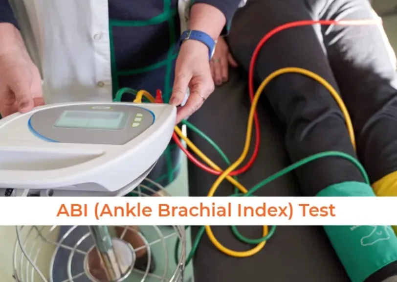 What is an ABI (Ankle Brachial Index) Test?